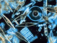 Phytoplankton are microscopic and can only be seen using a microscope. These single celled phytoplankton are called diatoms. Image: Public domain.