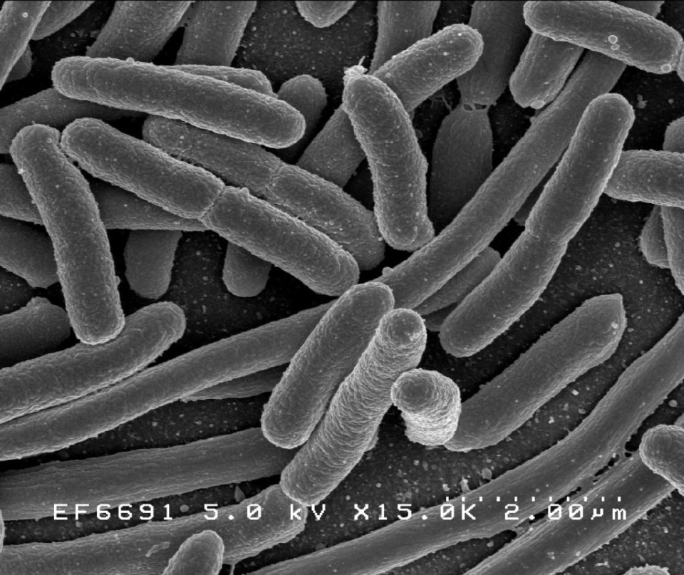 This is a scanning electron micrograph of a rod shaped bacteria. Image: Rocky Mountain Laboratories, NIAID, NIH.